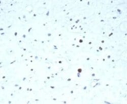 Pax7 Rabbit anti-Human, Clone: PAX7/7079R, Novus Biologicals 100 &mu;g;
